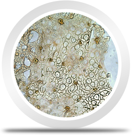 Mikroskopie fossiler Pflanzenreste
